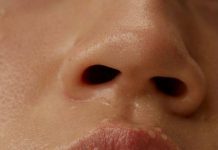 Способи боротьби з обвітрюванням та тріщинами губ в осінньо-зимовий період